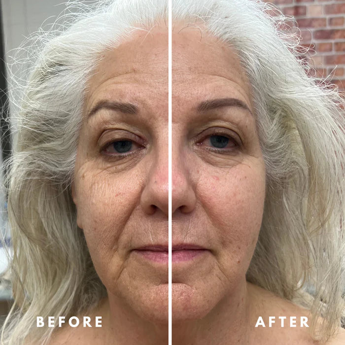 Professional Lymphatic Drainage Brush 🌿 | Ergonomic Design for Daily Skincare & Wellness ✨